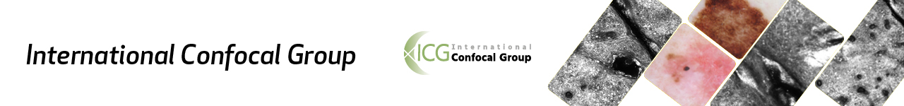 ICG – International Confocal Group